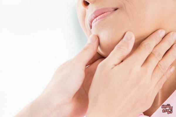 پرکاری تیروئید