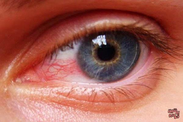 تولید شبکیه چشم با استفاده از سلول‌های بنیادی