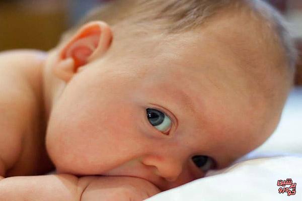 تشخیص زردی نوزادان در کمتر از 10 دقیقه