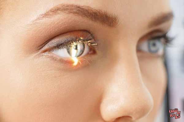 فناوری جدید برای درمان قطعی آب سیاه چشم