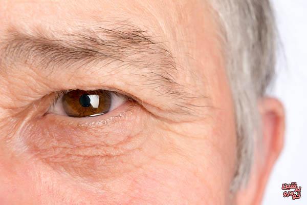 پیش‌بینی سن افراد با بررسی گوشه چشم آنها