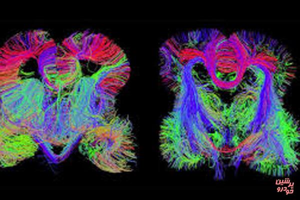 روش جدیدی برای نقشه‌برداری از مغز