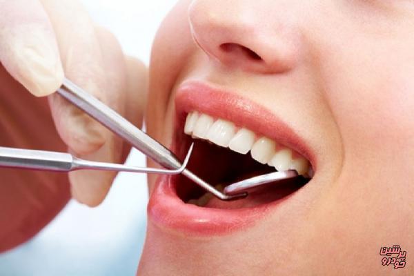 تاثیر مصرف زیاد فلوراید بر روی مینای دندان
