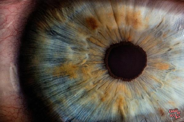 بازیابی ژنتیک بینایی برای اولین بار در جهان
