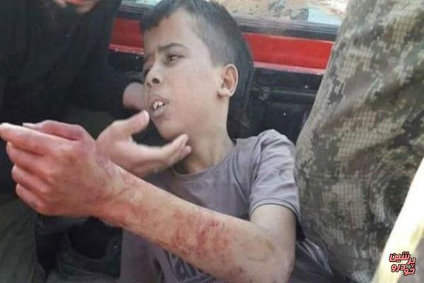 کودکی دیگر در حلب ذبح شد+عکس