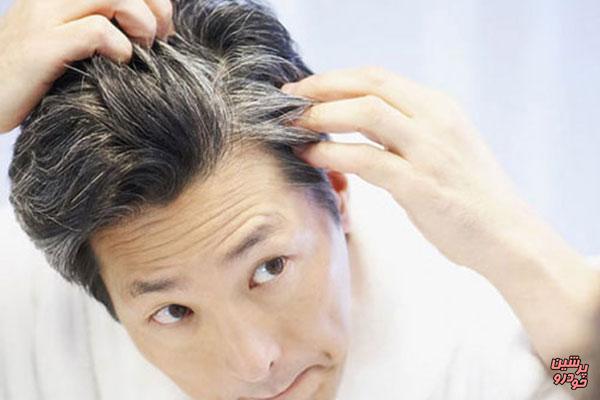 روش درمان زود سفید شدن مو