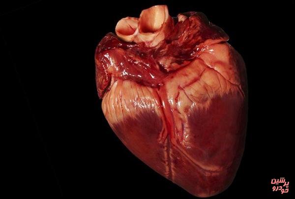 تولد نوزادی با قلب نصفه+عکس