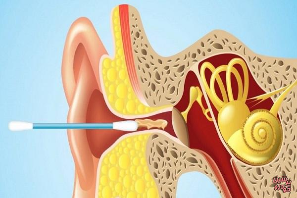 عوارض استفاده از گوش‌ پاک‌کن ها