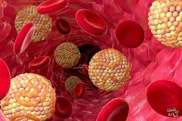 عوامل ایجاد کننده کلسترول خون