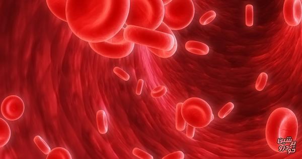 چگونه متوجه کم خونی شویم؟ 