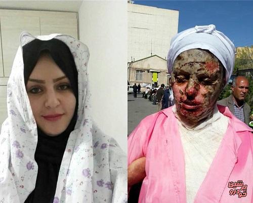 پیگیری پرونده اسیدپاشی به دختر تبریزی