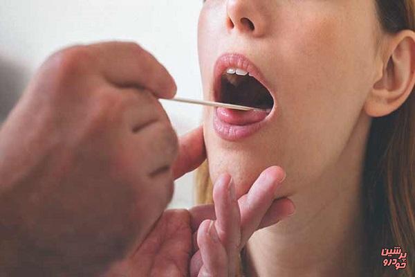 نشانه های سرطان روی زبان